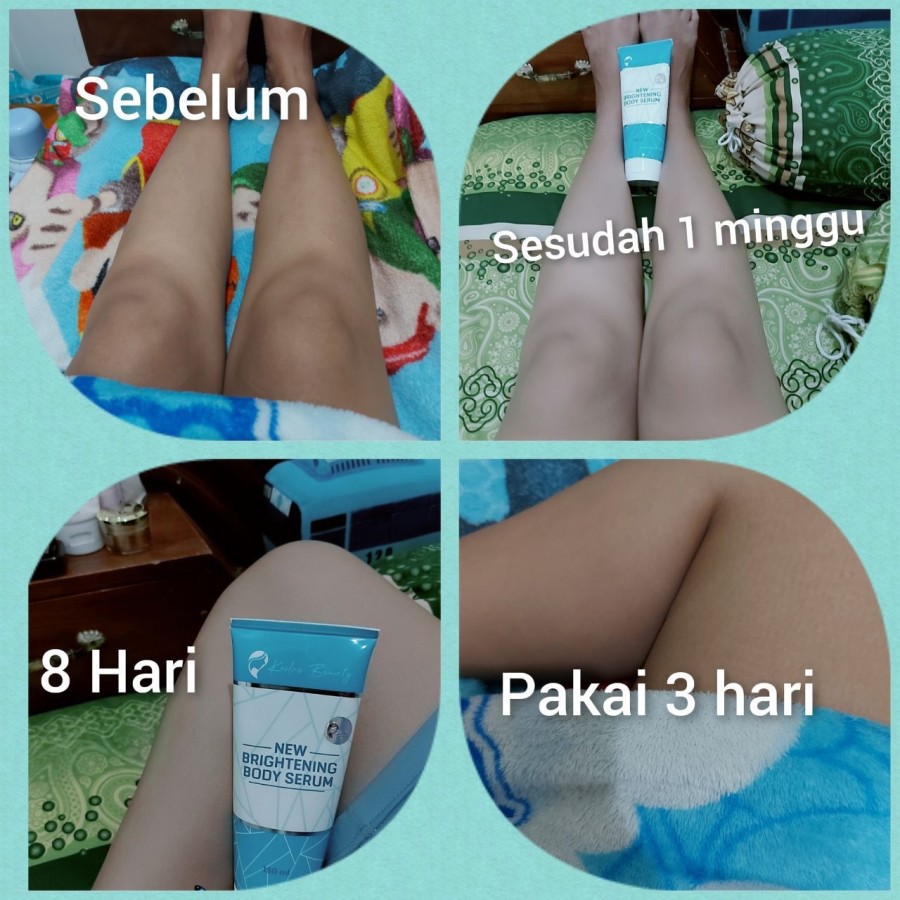 Kedas Beauty Body Serum Pemutih Original Kemasan Baru