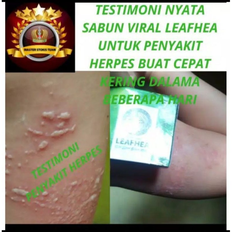 [COD] SABUN LEAFHEA GLUTHA ORIGINAL UNTUK FORMULASI LENGKAP WAJAH CANTIK ANDA
