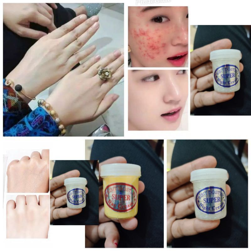 Aschosme BIBIT DOSTING / CREAM Dosting  whitening BDK BDM