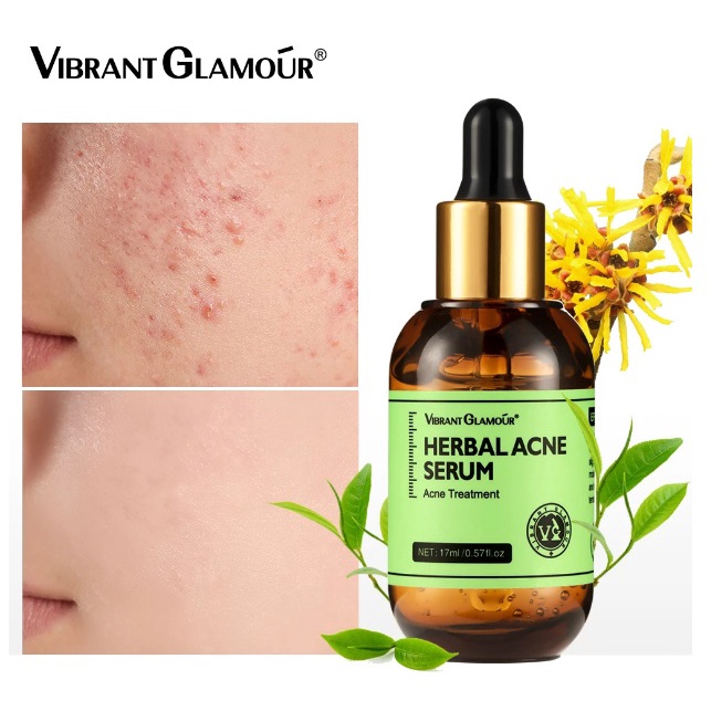 ORIGINAL VIBRANT GLAMOR 17ML Serum ANTI  Jerawat Pemutih Mengecilkan Pori-pori Menghilangkan Bekas L