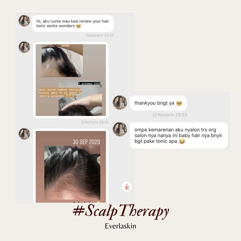 Scalp Therapy Natural Vegan Water-Based Hair Tonic - Everlaskin-6