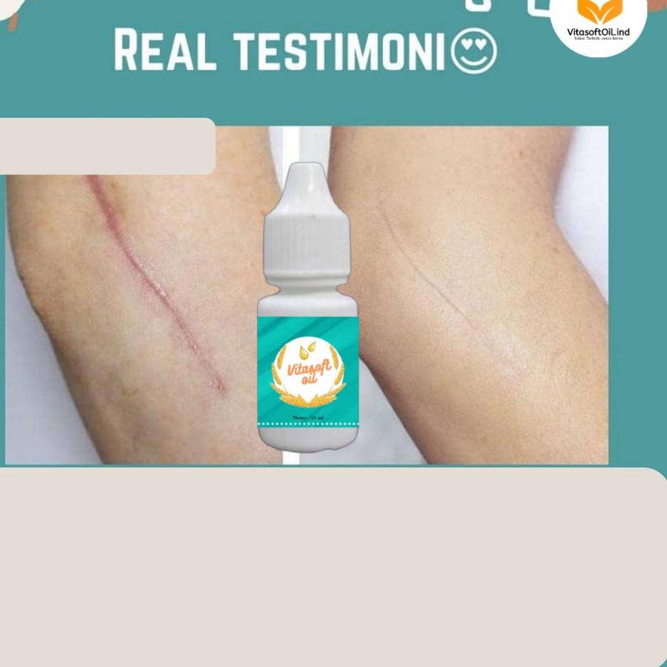 ⇢ VITASOFTOIL Penghilang Keloid Selulit Stretchmark Bekas Luka Memutihkan Wajah Glowing ㅑ