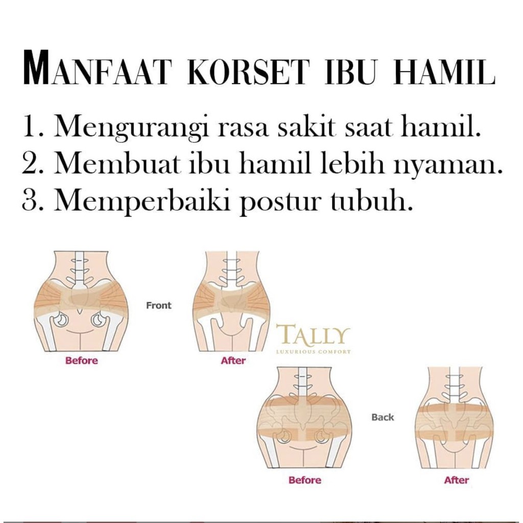 398 TALLY STAGEN - korset Penyangga Hamil (saat Hamil) / Pengecil Pinggul (pasca melahirkan) 2in1