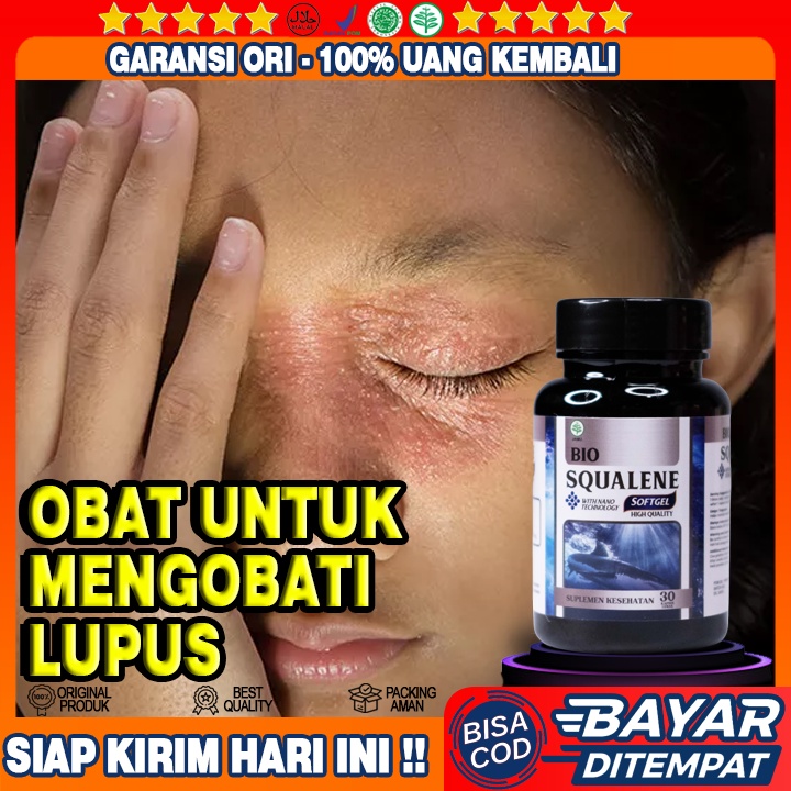 Obat Mencegah Penyakit Lupus - Obat Herbal Penyakit Lupus - Obat Penyakit Lupus / Autoimun -  Obat K
