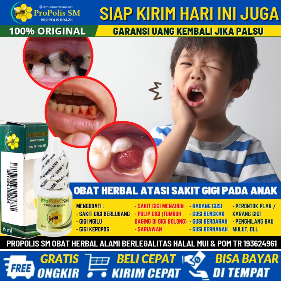 obat sakit gigi gusi bengkak pada anak 3