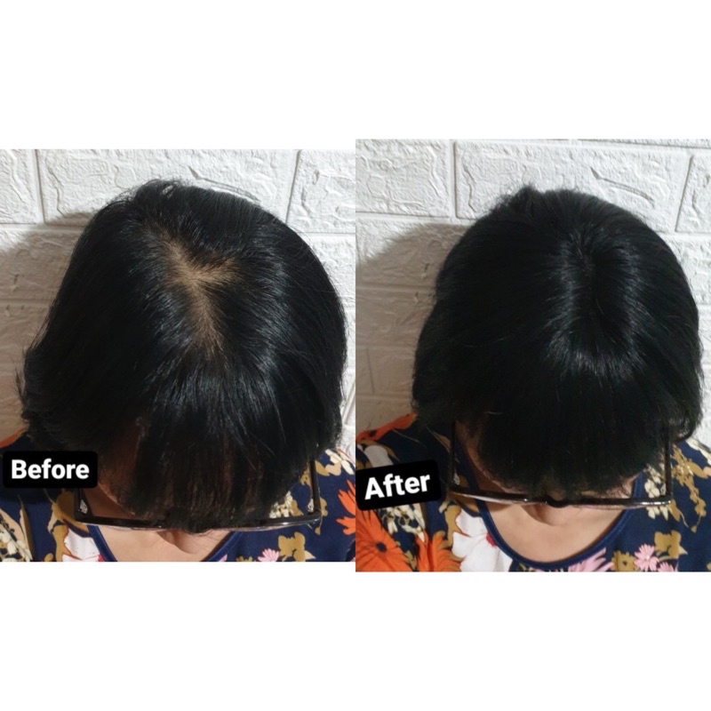 S30 P30 Toupee human Hair / Tempelan penutup botak rambut asli / toupee tipis layer rambut asli / hair top / hair topper (skin lace toupee)