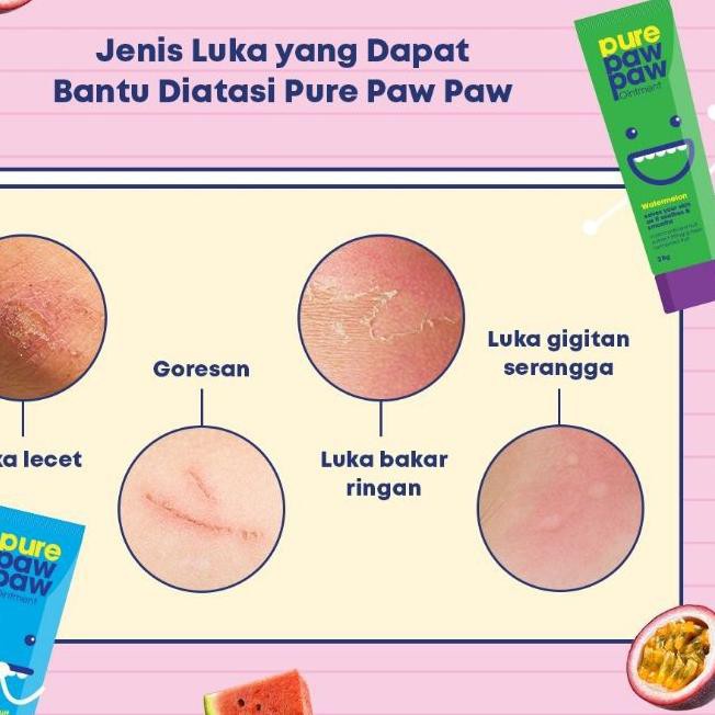 ❉ [] PURE PAW PAW OINTMENT / PURE PAWPAW OINTMENT 25gr / LIKE LUCAS PAPAW OINTMENT ALL VARIAN 25gr ☊