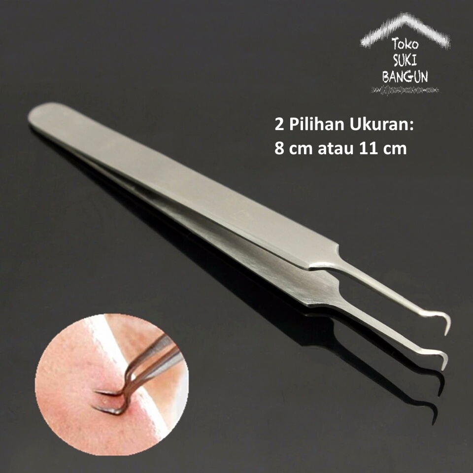 Pinset Komedo Jerawat Blackhead Stainless Steel Acne Remover