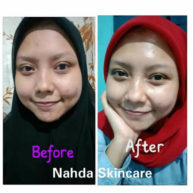NAHDA SKINCARE AMAN 100% GLOWING HALAL DAN BPOM (SKINCARE JERAWAT & NORMAL)