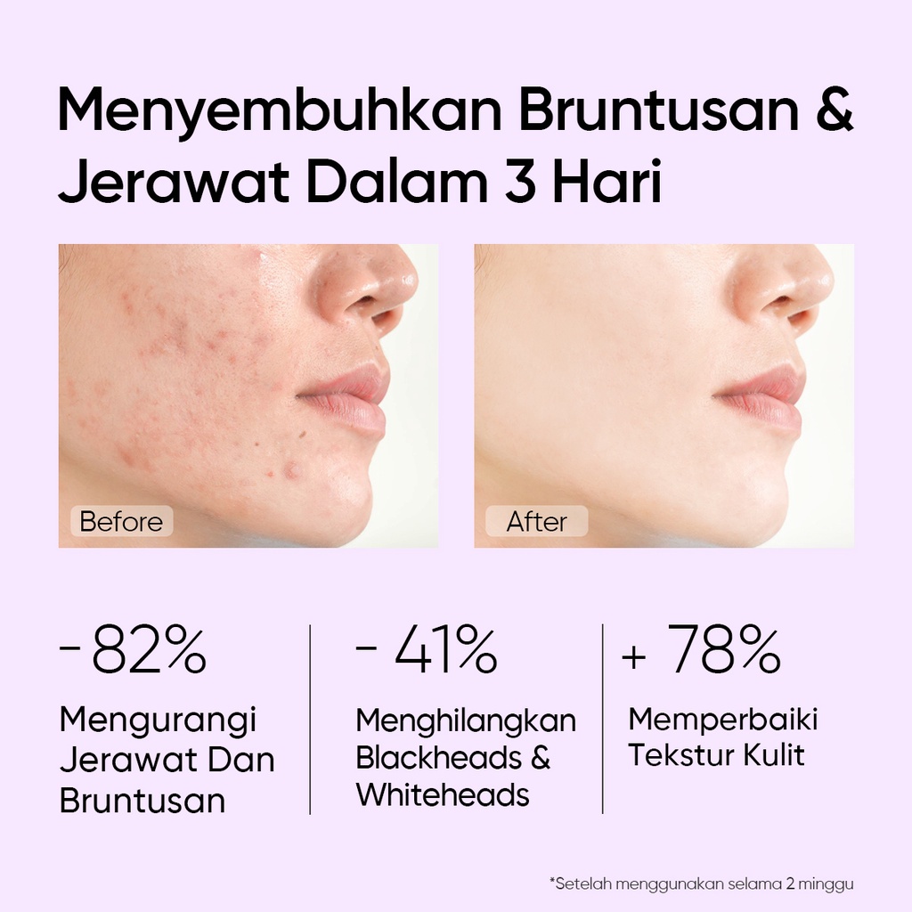 SKINTIFIC - 5% Aha Bha Pha Exfoliating Toner Face Eksfoliasi wajah Glow and Smooth Skin with Niacinamide