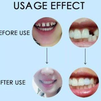 [PRODUK QQVHC] READY !! TEMPTOOTH /GEL PENAMBAL GIGI BOLONG/PEMBUAT GIGI PALSU/ LEM GIGI PALSU Y0G