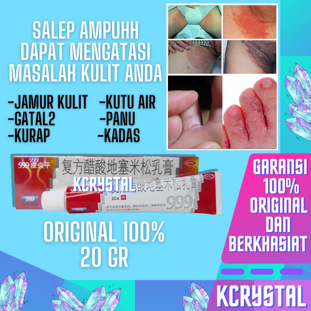 Salep 999 Original Obat Jamur Kulit Panu kadas Kurap Selangkangan Gatal Gatal Eksim Alergi Ampuh