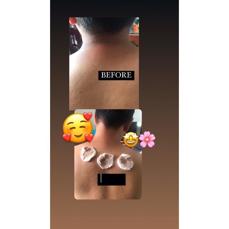 [BPOM]  YONI SKINCARE TONER BADAN PENGHILANG &amp; PEMBERSIH DAKI BADAN