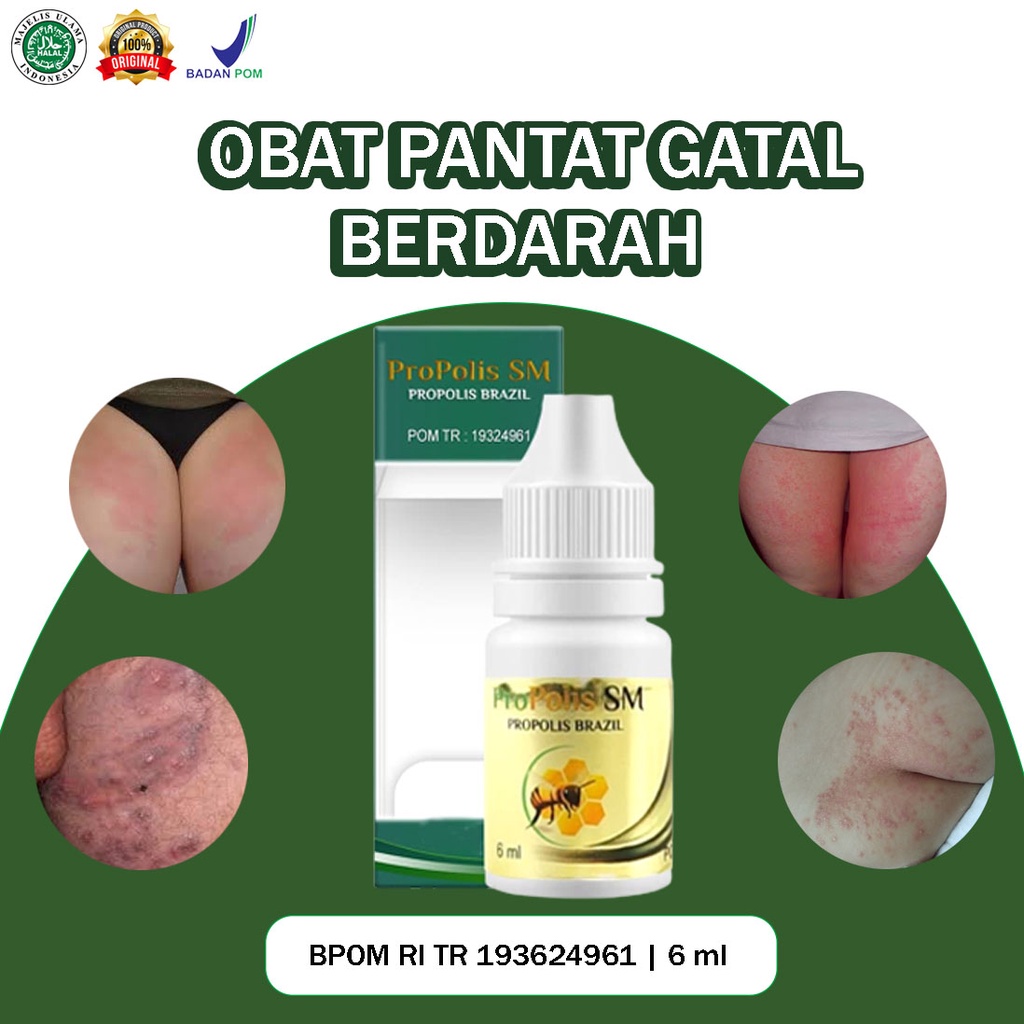 Obat Pantat Gatal Berdarah Gatal Area Bokong Dan Selangkangan Bentol Bersisik Bernanah Herbal Alami