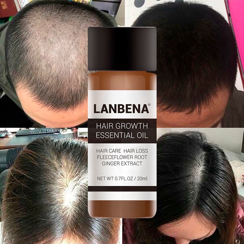 LANBENA serum penumbuh rambut herbal / lanbena hair growth serum