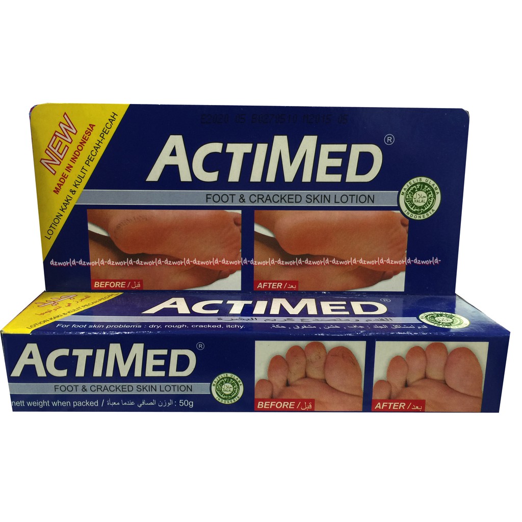 Actimed Food &amp; Cracked Skin Lotion 50gr mengatasi Tumit Kaki Pecah Pecah Kering Aktimed