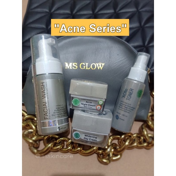 PROMO PAKET ACNE SERIES SPESIAL GIVE MSGLOW / Acne Ms glow / untuk kulit berjerawat / Acne series / 100% original