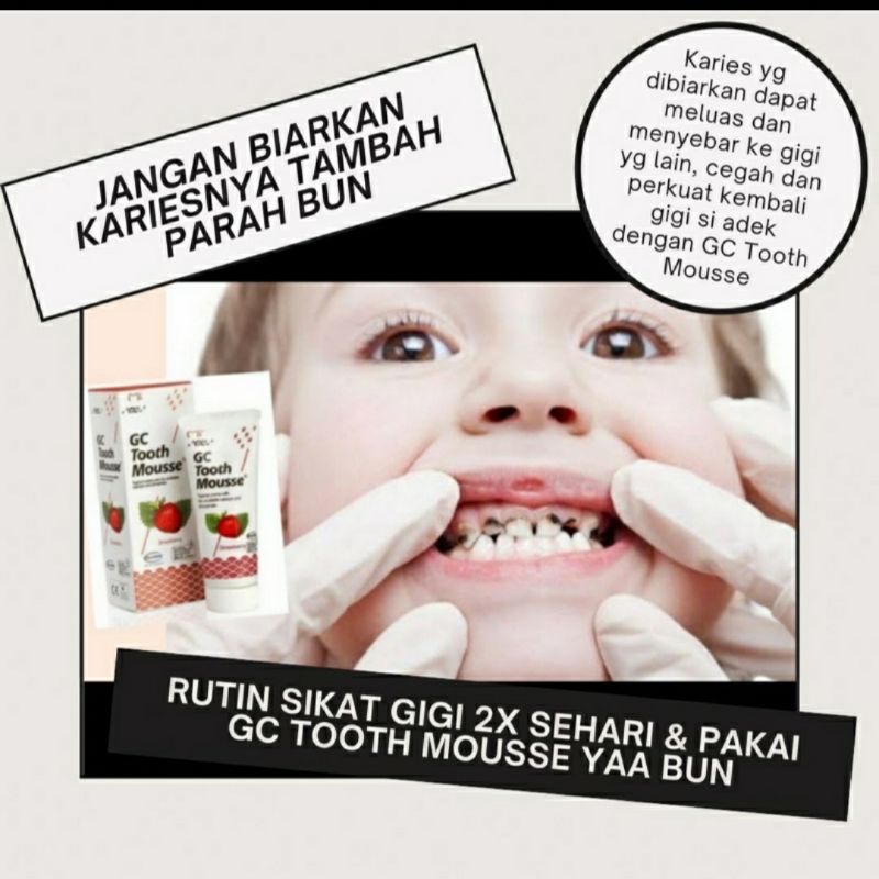 GC TOOTH MOUSSE anak ORIGINAL - share in jar 5 gram EXP 2024