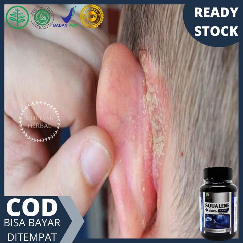 Obat kusta / hansen, Obat penghilang kusta, Obat kusta kering, Obat kusta basah, Obat kusta lepra, O