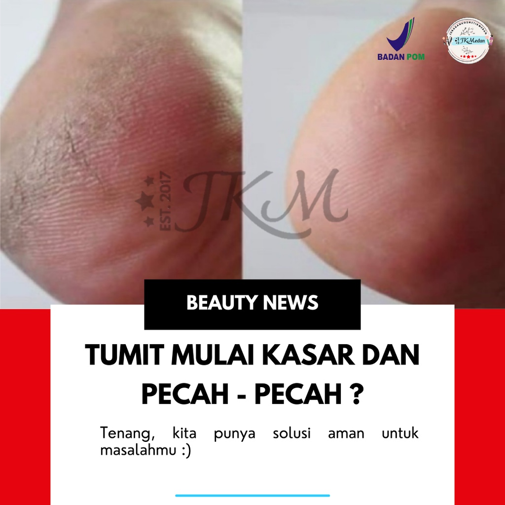 TUMITKU BPOM TUMITKU MENGATASI KAKI PECAH KAPALAN DENGAN CEPAT CAIRAN OBAT LUAR TUMITKU
