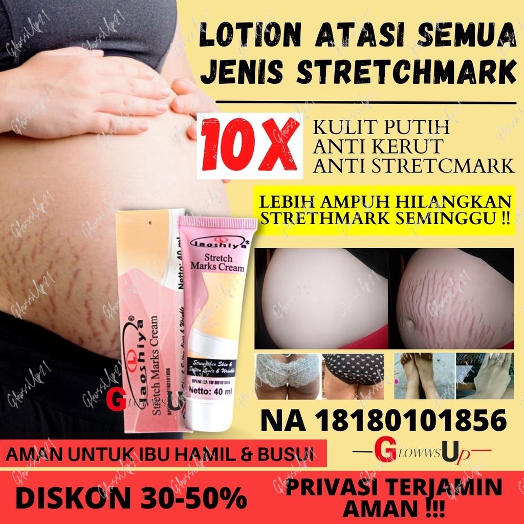 LAOSHIYA STRETCH MARKS CREAM ORIGINAL BPOM - STRETCH MARKS LAOSHIYA