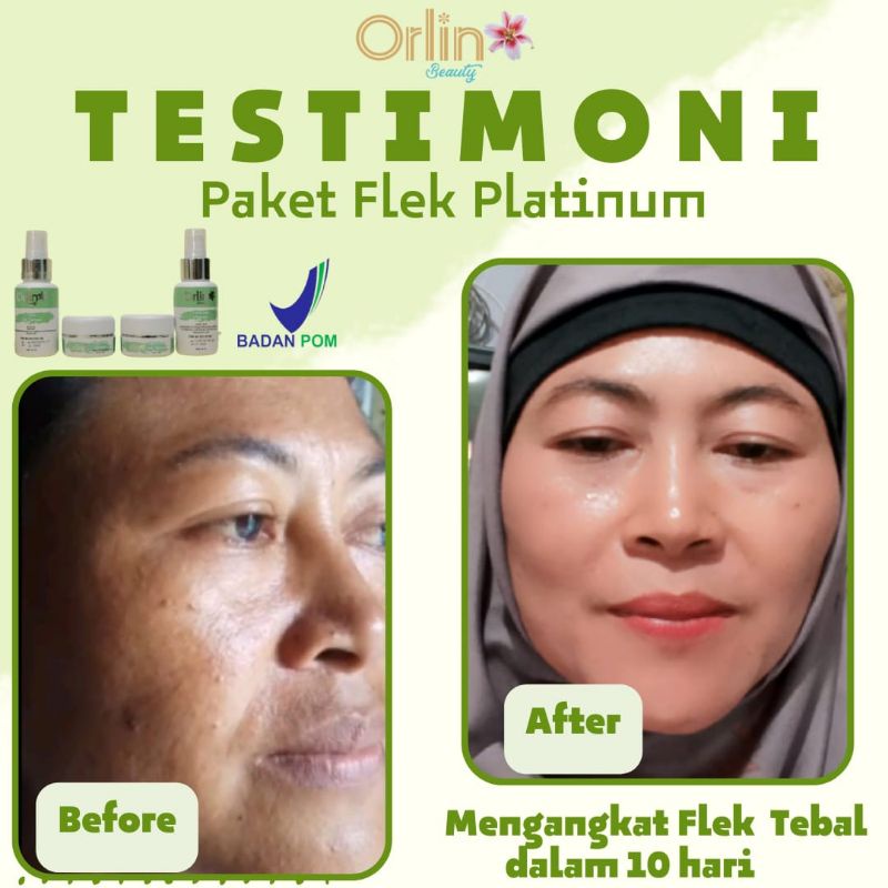 ( FREE HADIAH )ORLIN BEAUTY / ORLIN BEAUTY SKINCARE / ORLIN SKINCARE / PUTIH GLOWING 10HARI