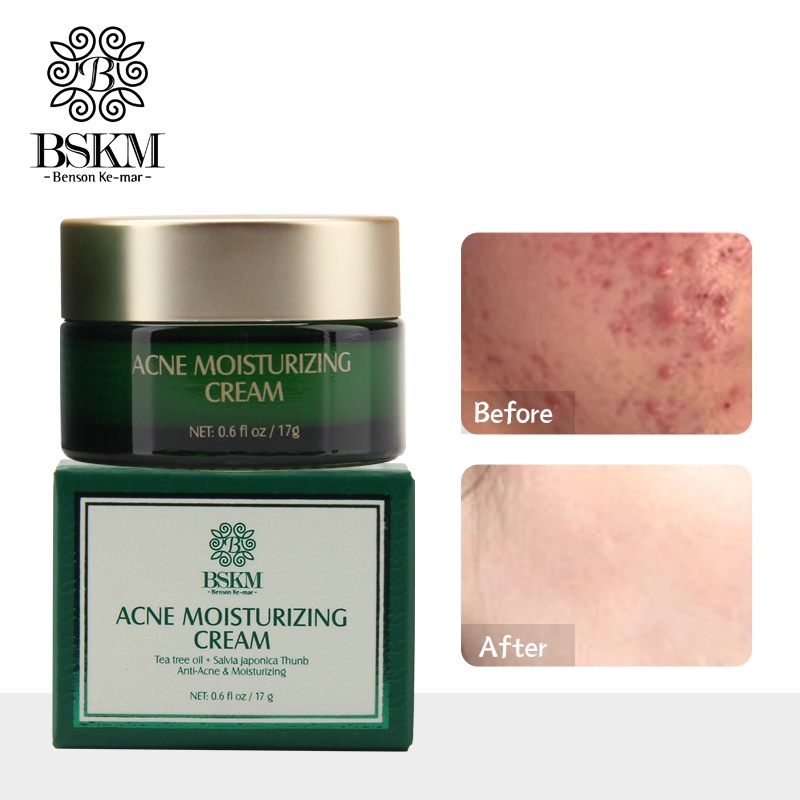 BSKM Acne Treatment Moisturizing Cream - Krim Jerawat &amp; Komedo Wajah Memperbaiki Kulit &amp; Mengecilkan Pori Wajah (17g)