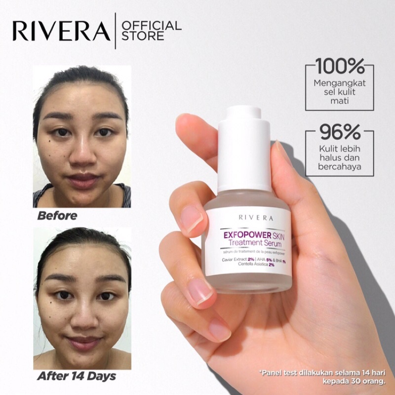 Rivera expo power skin treatment