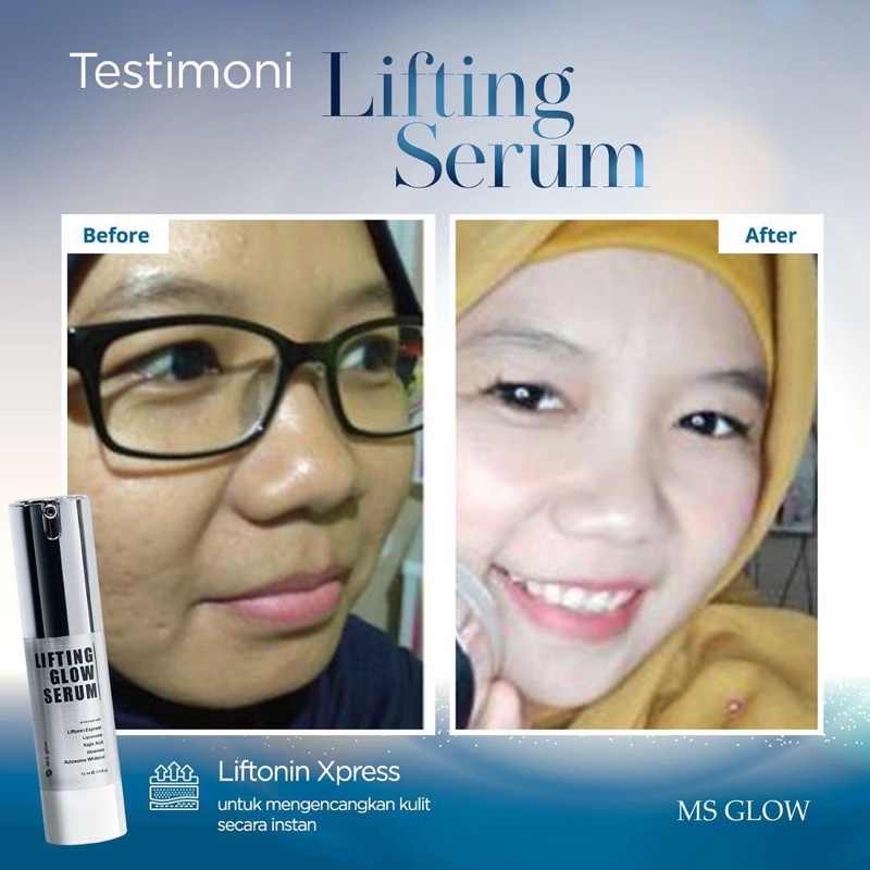 Original SERUM LIFTING MS GLOW