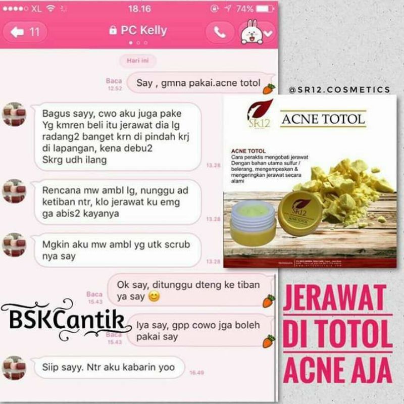 KRIM JERAWAT TOTOL SR12 BPOM AMAN / MENGEMPESKAN JERAWAT / CREAM TUMPAS JERAWAT / PERAWATAN JERAWAT