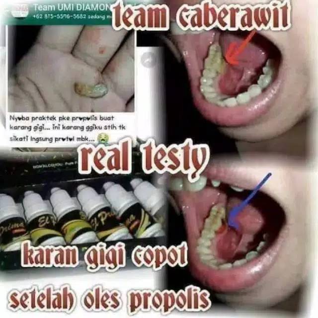 EL PRIMA PROPOLIS MSI | Propolis | MSI Propolis | Madu | Jamu Tetes