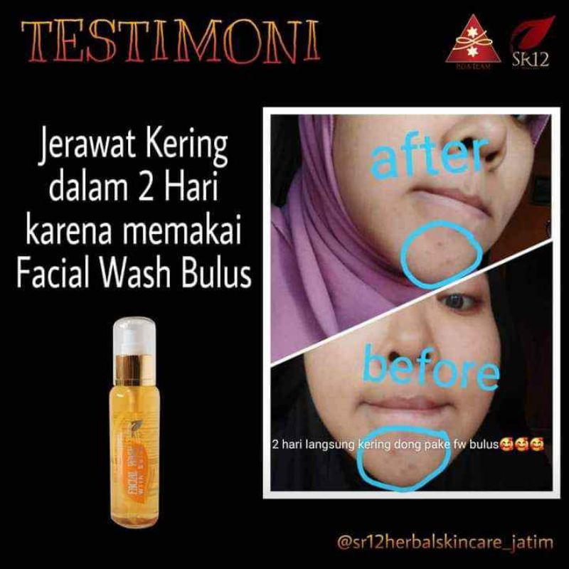 FACIAL WASH BULUS SR12 / SABUN CAIR BULUS / MEMUDARKAN FLEK HITAM / MENGHILANGKAN KOMEDO JERAWAT