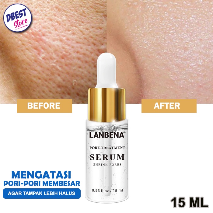 [SALE] Lanbena Serum Pengecil Pori Pori - Lanbena Pore Treatment Serum Shrink Pores - Perawatan Untuk Mengecilkan Pori Pori dan Menghaluskan Kulit Wajah - 15 ml