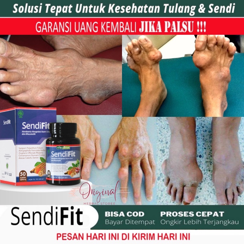 Obat kolestrol dan asam urat, Obat Remarik, Obat Nyeri asam urat , Obat Asam Urat, Obat penghilang b