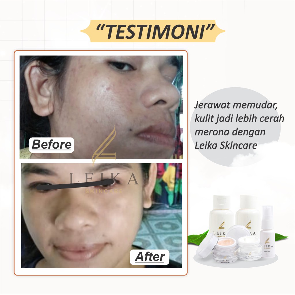Leika Skincare Paket 5 in 1-1