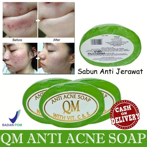 BEAUTY JAYA - ORIGINAL 100% BPOM - SABUN QM HIJAU ANTI ACNE - SABUN ANTI JERAWAT - MENGHILANGKAN JERAWAT - KOMEDO ( SABUN JERAWAT )