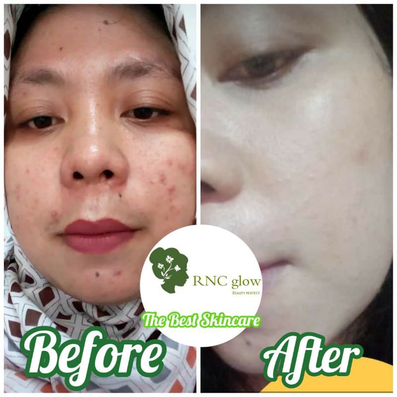 Rnc glow platinum BPOM