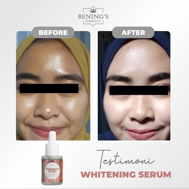 BENING'S SERUM WHITENING | MENCERAHKAN &amp; MENGGLOWINGKAN | BPOM &amp; HALAL