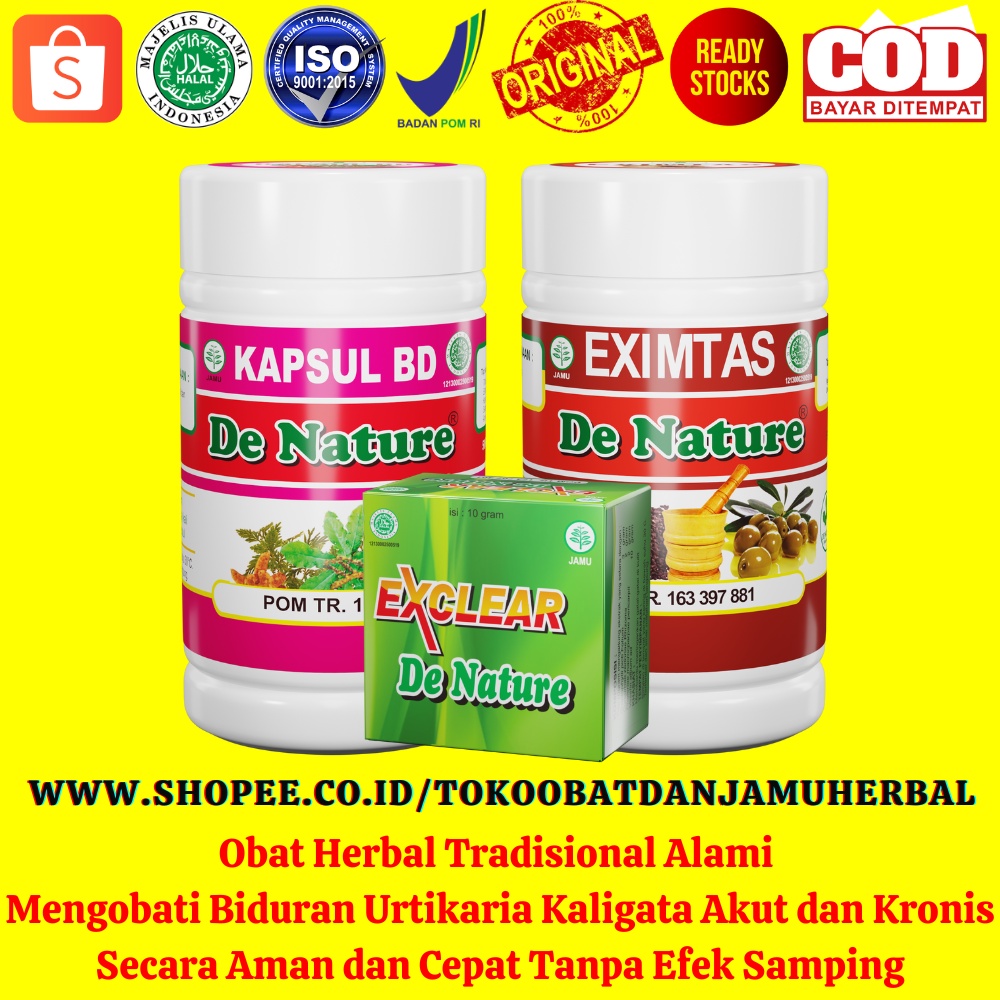 Paket Herbal Mengobati Biduran Urtikaria Kaligata Akut dan Kronis
