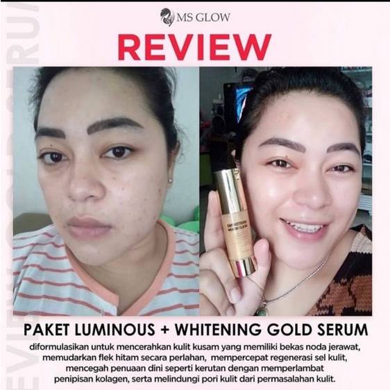 Ms Glow Gold Serum ORIGINAL