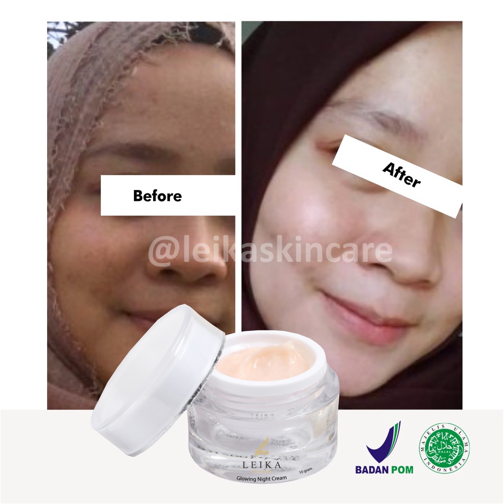 Ampuh! Krim untuk Mengurangi Minyak di Kulit Wajah Cream Menghilangkan Muka Berminyak Krim Muka untuk Kulit Berminyak Ampuh Penghilang Wajah Berminyak Glowing Night Cream Leika Skincare 10gr Resmi BPOM dan Halal