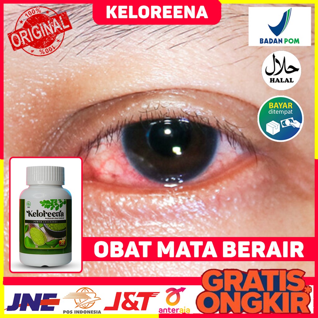 Obat Mata Berair, Mata Kering, Mata Bengkak, Bintitan, Mata Buram, Mata ...