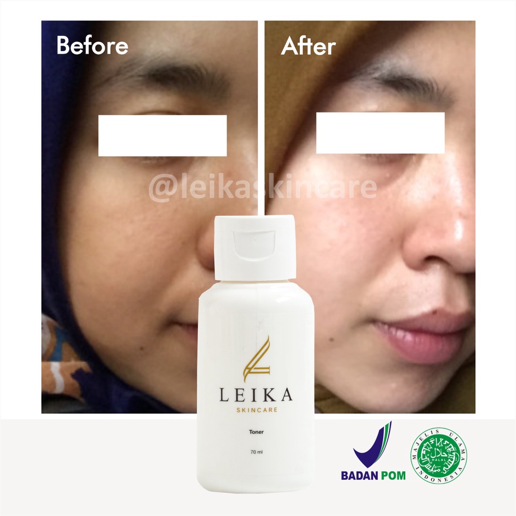 Toner Pelembab Kulit Wajah Kering / Berminyak Pelembab Wajah Cepat Bikin Putih Mencerahkan dan Glowing Ampuh Toner Leika Skincare Halal MUI Resmi BPOM