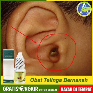 Obat Tetes Telinga Bernanah Dan Bau Herbal Laris Banyak Dicari Propolis Sm Brazil Asli 100 Original Shopee Indonesia