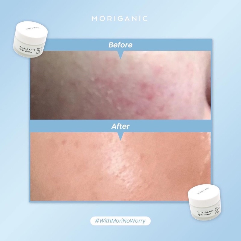 MORIGANIC Hydro Cream Moisturizer 30gr | Niacinamide, Centela Asiatica, and Hyaluronic Acid - Pelembab Wajah