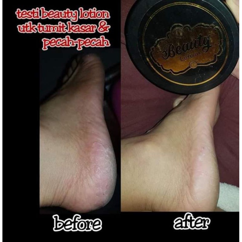 Beauty Lotion Viral / lotion pemutih BL