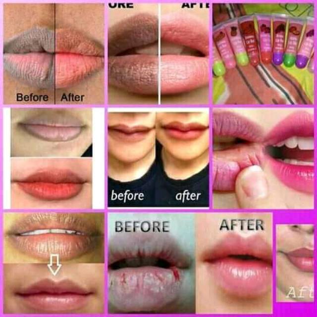 Kebaikan Vitamin E Untuk Bibir