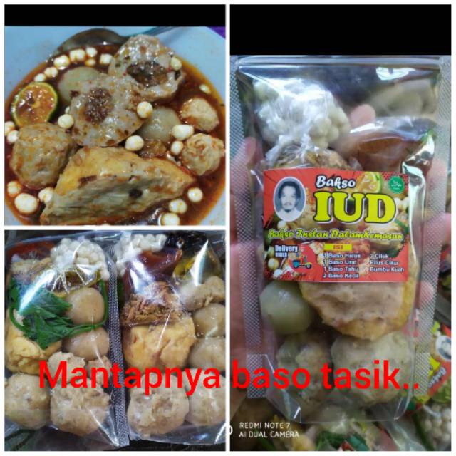 

Baso tasik IUD