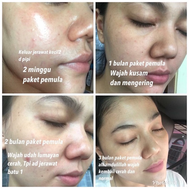 PAKET PEMULA SR12 BEST SELLER..!!! MEMPERBAIKI SKIN BARRIER KULIT / MENGEMBALIKAN KULIT WAJAH CANTIK ALAMI / PAKET SKINCARE SR 12 / PAKET LENGKAP SR12 UNTUK MEMBERSIHKAN KULIT WAJAH, SKIN BARRIER KULIT WAJAH &amp; MELINDUNGI WAJAH DARI PAPARAN SINAR UV