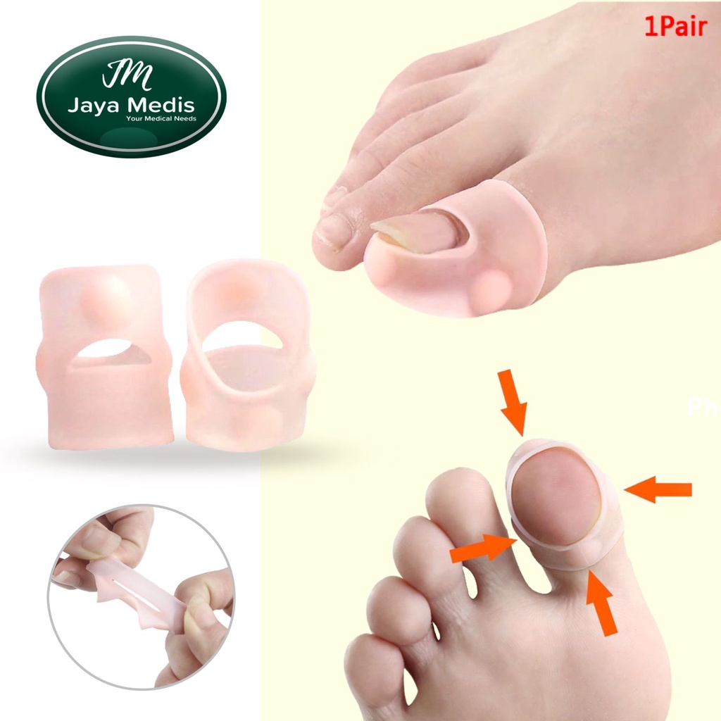 Separator Jari Kaki - Hallux Valgus Bahan Silikon - Bunion - 1 pasang